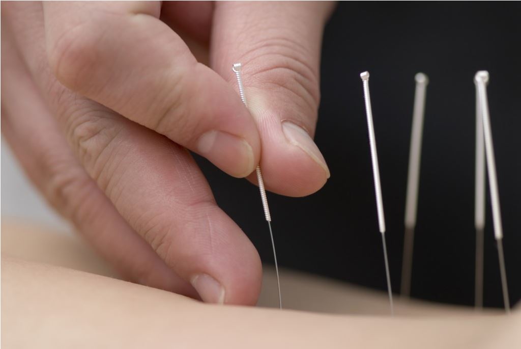 bodywords acupuncture treatments
